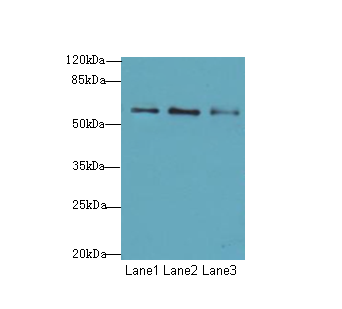 GPCR6 / GPR101 Antibody - Western blot. All lanes: GPR101 antibody at 6 ug/ml. Lane 1: MCF7 whole cell lysate. Lane 2: U87 whole cell lysate. Lane 3: Caco-2 whole cell lysate. Secondary Goat polyclonal to Rabbit IgG at 1:10000 dilution. Predicted band size: 57 kDa. Observed band size: 57 kDa.