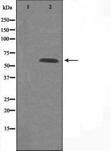 GPCR6 / GPR101 Antibody - Western blot analysis of extracts of COS-7 cells using GPR101 antibody. The lane on the left is treated with the antigen-specific peptide.