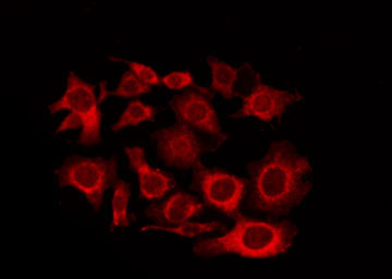 GPCR6 / GPR101 Antibody - Staining HeLa cells by IF/ICC. The samples were fixed with PFA and permeabilized in 0.1% Triton X-100, then blocked in 10% serum for 45 min at 25°C. The primary antibody was diluted at 1:200 and incubated with the sample for 1 hour at 37°C. An Alexa Fluor 594 conjugated goat anti-rabbit IgG (H+L) Ab, diluted at 1/600, was used as the secondary antibody.
