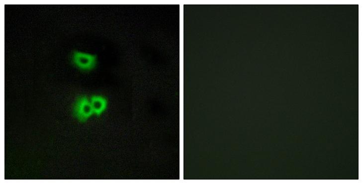 GPCR6 / GPR101 Antibody - Peptide - + Immunofluorescence analysis of A549 cells, using GPR101 antibody.