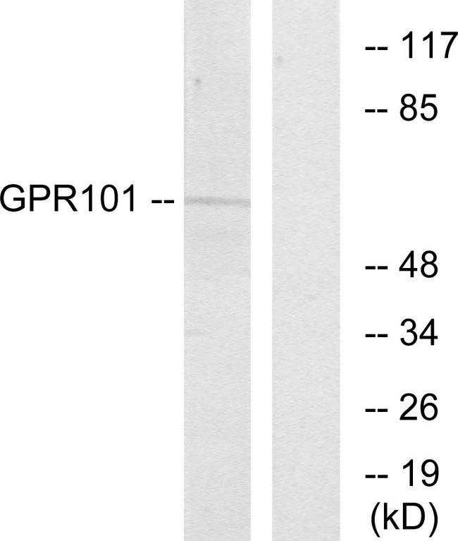 GPCR6 / GPR101 Antibody - Western blot analysis of extracts from COS-7 cells, using GPR101 antibody.