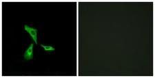 GPCR6 / GPR101 Antibody - Peptide - + Immunofluorescence analysis of HeLa cells, using GPR101 antibody.
