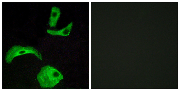 GPCRW / GPR18 Antibody - Immunofluorescence analysis of HeLa cells, using GPR18 Antibody. The picture on the right is blocked with the synthesized peptide.