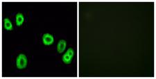 GPCRW / GPR18 Antibody - Immunofluorescence analysis of HUVEC cells, using GPR18 Antibody. The picture on the right is blocked with the synthesized peptide.