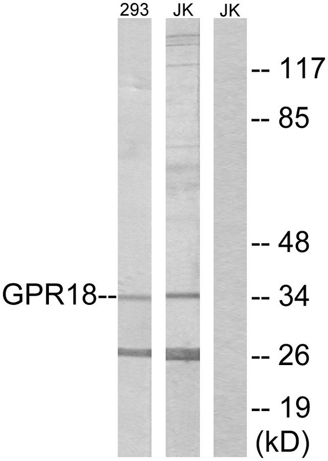 GPCRW / GPR18 Antibody - Western blot analysis of lysates from 293 and Jurkat cells, using GPR18 Antibody. The lane on the right is blocked with the synthesized peptide.
