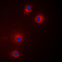 GPCRW / GPR18 Antibody - Immunofluorescent analysis of GPR18 staining in Jurkat cells. Formalin-fixed cells were permeabilized with 0.1% Triton X-100 in TBS for 5-10 minutes and blocked with 3% BSA-PBS for 30 minutes at room temperature. Cells were probed with the primary antibody in 3% BSA-PBS and incubated overnight at 4 C in a humidified chamber. Cells were washed with PBST and incubated with a DyLight 594-conjugated secondary antibody (red) in PBS at room temperature in the dark. DAPI was used to stain the cell nuclei (blue).