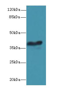 GPCRW / GPR18 Antibody - Western blot. All lanes: GPR18 antibody at 8 ug/ml+ Mouse brain tissue Goat polyclonal to rabbit at 1:10000 dilution. Predicted band size: 38 kDa. Observed band size: 38 kDa.