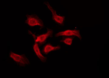 GPCRW / GPR18 Antibody - Staining HT29 cells by IF/ICC. The samples were fixed with PFA and permeabilized in 0.1% Triton X-100, then blocked in 10% serum for 45 min at 25°C. The primary antibody was diluted at 1:200 and incubated with the sample for 1 hour at 37°C. An Alexa Fluor 594 conjugated goat anti-rabbit IgG (H+L) Ab, diluted at 1/600, was used as the secondary antibody.