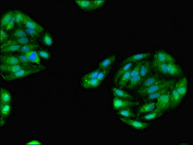 GPD1 Antibody - Immunofluorescent analysis of HepG2 cells using GPD1 Antibody at dilution of 1:100 and Alexa Fluor 488-congugated AffiniPure Goat Anti-Rabbit IgG(H+L)