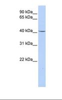 GPD1 Antibody - Fetal lung lysate. Antibody concentration: 1.0 ug/ml. Gel concentration: 12%.  This image was taken for the unconjugated form of this product. Other forms have not been tested.