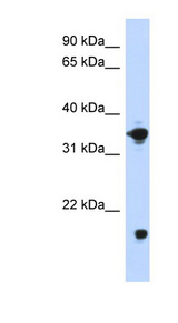 GPD1 Antibody - GPD1 antibody Western blot of Transfected 293T cell lysate. This image was taken for the unconjugated form of this product. Other forms have not been tested.