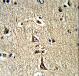 GPD1 Antibody - Formalin-fixed and paraffin-embedded human brain tissue reacted with GPD1 Antibody , which was peroxidase-conjugated to the secondary antibody, followed by DAB staining. This data demonstrates the use of this antibody for immunohistochemistry; clinical relevance has not been evaluated.