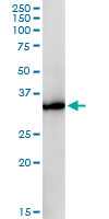 GPD1 Antibody - GPD1 monoclonal antibody (M01), clone 3C10-1C4. Western Blot analysis of GPD1 expression in human kidney.