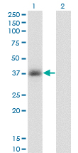 GPD1 Antibody - Western Blot analysis of GPD1 expression in transfected 293T cell line by GPD1 monoclonal antibody (M01), clone 3C10-1C4.Lane 1: GPD1 transfected lysate (Predicted MW: 37.6 KDa).Lane 2: Non-transfected lysate.