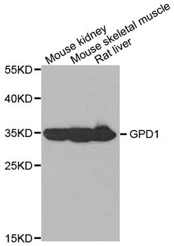 GPD1 Antibody - Western blot analysis of extracts of various tissues.
