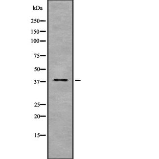GPD1 Antibody - Western blot analysis GPD1 using COLO205 whole cells lysates