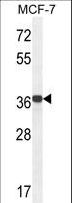 GPD1L Antibody - GPD1L Antibody western blot of MCF-7 cell line lysates (35 ug/lane). The GPD1L antibody detected the GPD1L protein (arrow).