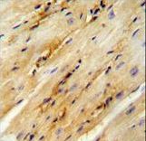 GPD1L Antibody - GPD1L antibody immunohistochemistry of formalin-fixed and paraffin-embedded mouse heart tissue followed by peroxidase-conjugated secondary antibody and DAB staining.
