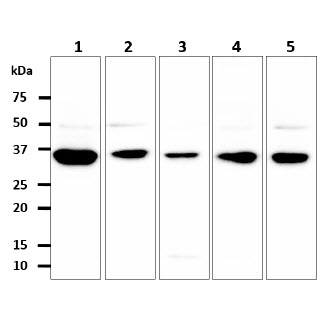 GPD1L Antibody - The cell lysates (40ug) were resolved by SDS-PAGE, transferred to PVDF membrane and probed with anti-human GPD1L antibody (1:500). Proteins were visualized using a goat anti-mouse secondary antibody conjugated to HRP and an ECL detection system. Lane 1. : MCF7 cell lysate Lane 2. : 293T cell lysate Lane 3. : Jurkat cell lysate Lane 4 : SW480 cell lysate Lane 5 : PC3 cell lysate The cell lysates (40ug) were resolved by SDS-PAGE, transferred to PVDF membrane and probed with anti-human GPD1L antibody (1:1000). Proteins were visualized using a goat anti-mouse secondary antibody conjugated to HRP and an ECL detection system. Lane 1. : 293T cell lysate Lane 2. : GPD1L Transfected 293T cell lysate
