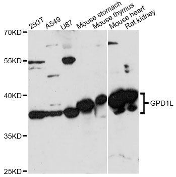 GPD1L Antibody - Western blot analysis of extracts of various cell lines, using GPD1L antibody at 1:3000 dilution. The secondary antibody used was an HRP Goat Anti-Rabbit IgG (H+L) at 1:10000 dilution. Lysates were loaded 25ug per lane and 3% nonfat dry milk in TBST was used for blocking. An ECL Kit was used for detection and the exposure time was 1s.