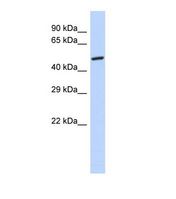 GPD2 Antibody - Western blot of Human 293T. GPD2 antibody dilution 1.0 ug/ml.  This image was taken for the unconjugated form of this product. Other forms have not been tested.