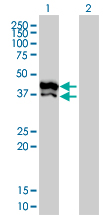GPD2 Antibody - Western Blot analysis of GPD2 expression in transfected 293T cell line by GPD2 monoclonal antibody (M02), clone 2C11-1F4.Lane 1: GPD2 transfected lysate(41 KDa).Lane 2: Non-transfected lysate.