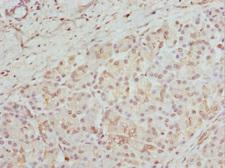 GPD2 Antibody - Immunohistochemistry of paraffin-embedded human pancreatic tissue at dilution 1:100