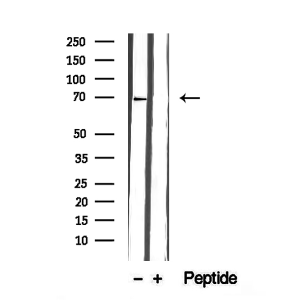 GPD2 Antibody - Western blot analysis of extracts of mouse liver tissue using GPD2 antibody.