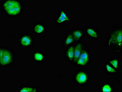 GPER1 / GPR30 Antibody - Immunofluorescent analysis of MCF-7 cells diluted at 1:100 and Alexa Fluor 488-congugated AffiniPure Goat Anti-Rabbit IgG(H+L)