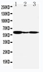 GPER1 / GPR30 Antibody - WB of GPER1 / GPR30 antibody. Lane 1: COLO320 Cell Lysate. Lane 2: MCF-7 Cell Lysate. Lane 3: COS7 Cell Lysate.