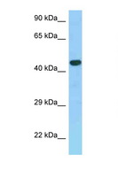 GPER1 / GPR30 Antibody - GPER / GPR30 antibody Western blot of Fetal Kidney lysate. Antibody concentration 1 ug/ml.  This image was taken for the unconjugated form of this product. Other forms have not been tested.