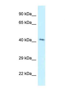 GPER1 / GPR30 Antibody - GPER / GPR30 antibody Western blot of Jurkat Cell lysate. Antibody concentration 1 ug/ml.  This image was taken for the unconjugated form of this product. Other forms have not been tested.