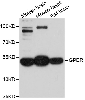 GPER1 / GPR30 Antibody - Western blot analysis of extracts of various cell lines, using GPER1 antibody at 1:1000 dilution. The secondary antibody used was an HRP Goat Anti-Rabbit IgG (H+L) at 1:10000 dilution. Lysates were loaded 25ug per lane and 3% nonfat dry milk in TBST was used for blocking. An ECL Kit was used for detection and the exposure time was 90s.