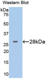 GPI Antibody - Western blot of recombinant GPI.  This image was taken for the unconjugated form of this product. Other forms have not been tested.