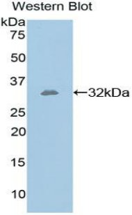 GPI Antibody - Western blot of recombinant GPI.  This image was taken for the unconjugated form of this product. Other forms have not been tested.