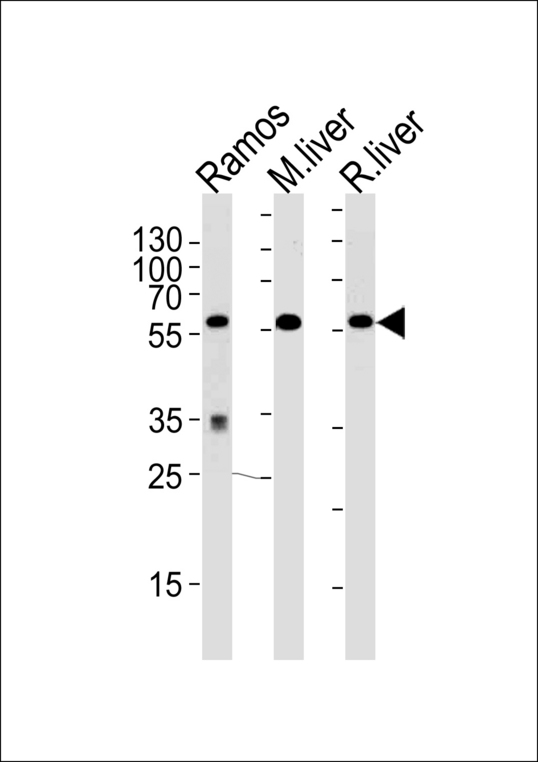 GPI Antibody - Western blot of lysates from Ramos cell line,mouse liver,rat liver tissue (from left to right),using GPI Antibody. Antibody was diluted at 1:1000 at each lane. A goat anti-rabbit IgG H&L (HRP) at 1:5000 dilution was used as the secondary antibody.Lysates at 35ug per lane.