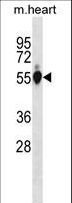 GPI Antibody - Mouse Gpi Antibody western blot of mouse heart tissue lysates (35 ug/lane). The Mouse Gpi antibody detected the Mouse Gpi protein (arrow).