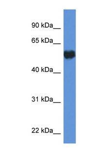 GPI Antibody - GPI antibody Western blot of HepG2 Cell lysate. Antibody concentration 1 ug/ml.  This image was taken for the unconjugated form of this product. Other forms have not been tested.