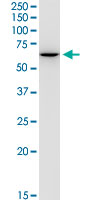 GPI Antibody - GPI monoclonal antibody (M01), clone 8B8. Western Blot analysis of GPI expression in MCF-7.