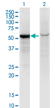 GPI Antibody - Western Blot analysis of GPI expression in transfected 293T cell line by GPI monoclonal antibody (M01), clone 8B8.Lane 1: GPI transfected lysate (Predicted MW: 63.1 KDa).Lane 2: Non-transfected lysate.