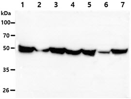 GPI Antibody - The Cell lysates (40ug) were resolved by SDS-PAGE, transferred to PVDF membrane and probed with anti-human GPI antibody (1:1000). Proteins were visualized using a goat anti-mouse secondary antibody conjugated to HRP and an ECL detection system. Lane 1. : HeLa cell lysate Lane 2. : HepG2 cell lysate Lane 3. : A549 cell lysate Lane 4. : Jurkat cell lysate Lane 5. : U87MG cell lysate Lane 6. : Raji cell lysate Lane 7. : MCF7 cell lysate