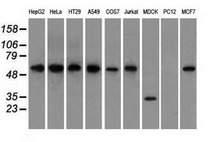 GPI Antibody - Western blot analysis of extracts (35ug) from 9 different cell lines by using anti-GPI monoclonal antibody.