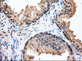 GPI Antibody - Immunohistochemical staining of paraffin-embedded Human prostate tissue using anti-GPI mouse monoclonal antibody. (Dilution 1:50).