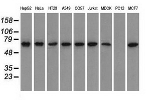 GPI Antibody - Western blot analysis of extracts (35ug) from 9 different cell lines by using anti-GPI monoclonal antibody.