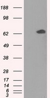 GPI Antibody - HEK293T cells were transfected with the pCMV6-ENTRY control (Left lane) or pCMV6-ENTRY GPI (Right lane) cDNA for 48 hrs and lysed. Equivalent amounts of cell lysates (5 ug per lane) were separated by SDS-PAGE and immunoblotted with anti-GPI.