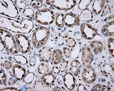 GPI Antibody - IHC of paraffin-embedded Kidney tissue using anti-GPI mouse monoclonal antibody. (Dilution 1:50).