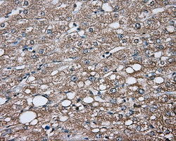 GPI Antibody - Immunohistochemical staining of paraffin-embedded liver tissue using anti-GPI mouse monoclonal antibody. (Dilution 1:50).