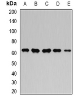 GPI Antibody - Western blot analysis of GPI expression in MCF7 (A); HeLa (B); mouse kidney (C); mouse heart (D); rat brain (E) whole cell lysates.