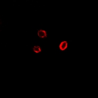 GPI Antibody - Immunofluorescent analysis of GPI staining in U2OS cells. Formalin-fixed cells were permeabilized with 0.1% Triton X-100 in TBS for 5-10 minutes and blocked with 3% BSA-PBS for 30 minutes at room temperature. Cells were probed with the primary antibody in 3% BSA-PBS and incubated overnight at 4 deg C in a humidified chamber. Cells were washed with PBST and incubated with a DyLight 594-conjugated secondary antibody (red) in PBS at room temperature in the dark.