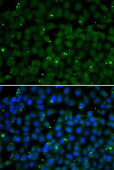 GPI Antibody - Immunofluorescence analysis of U2OS cells using GPI antibody. Blue: DAPI for nuclear staining.